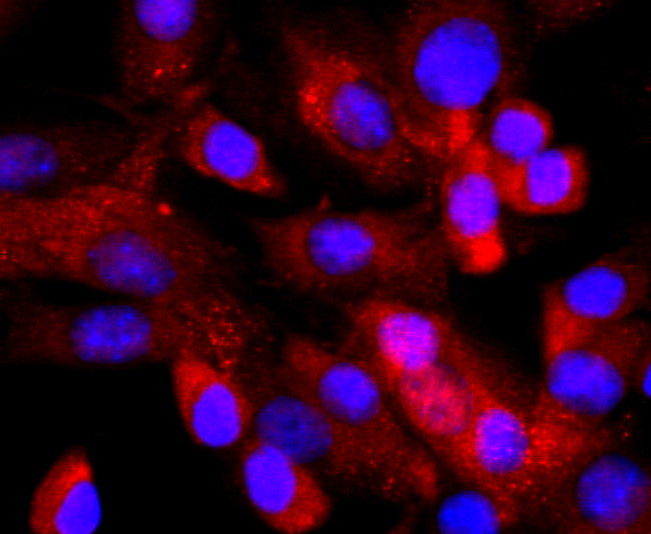 NFAT1 Rabbit mAb