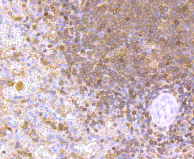 NFAT1 Rabbit mAb