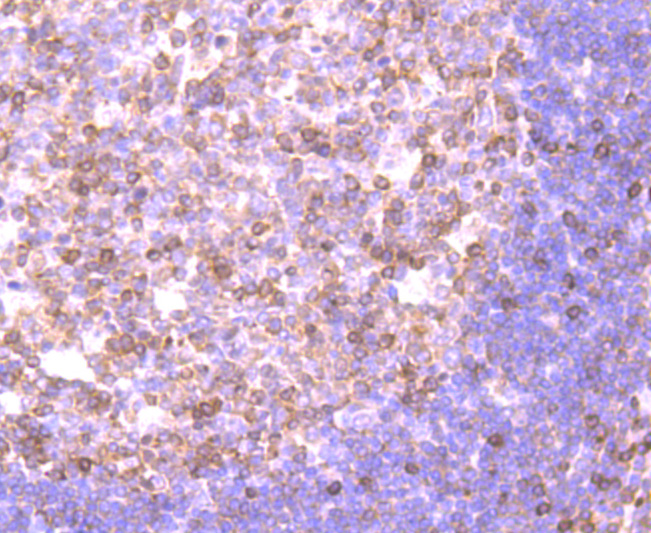 NFAT1 Rabbit mAb