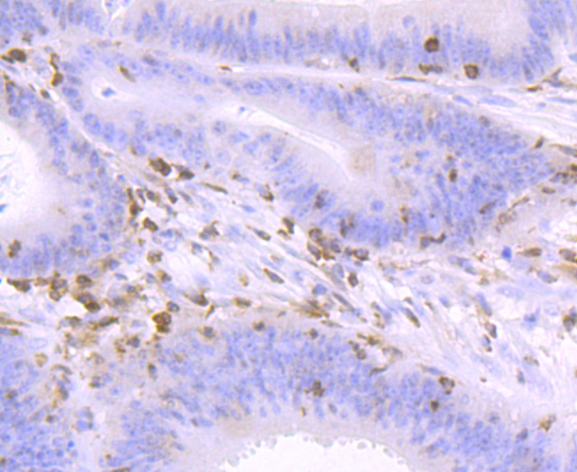 NFAT1 Rabbit mAb