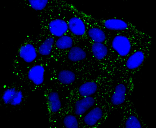 PKA 2 beta (regulatory subunit) Rabbit mAb