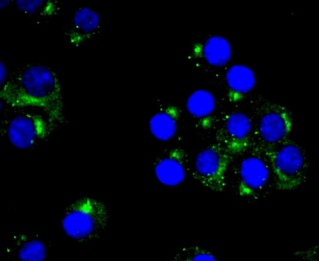 PKA 2 beta (regulatory subunit) Rabbit mAb