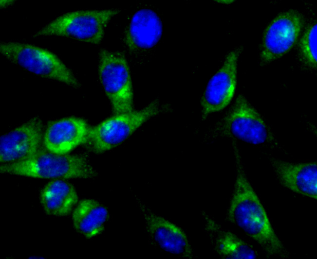 PKA 2 beta (regulatory subunit) Rabbit mAb