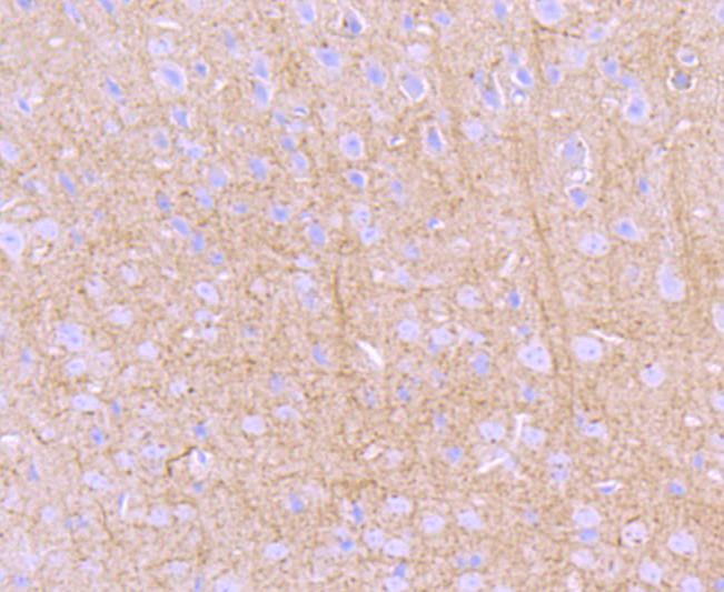 PKA 2 beta (regulatory subunit) Rabbit mAb