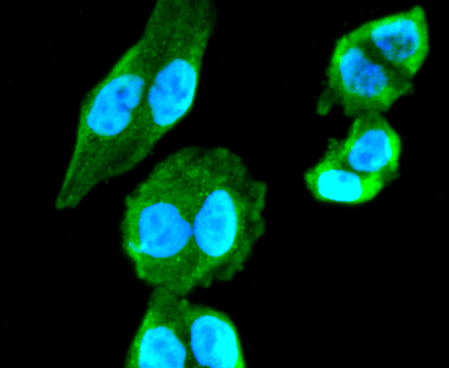 Choline Acetyltransferase Rabbit mAb