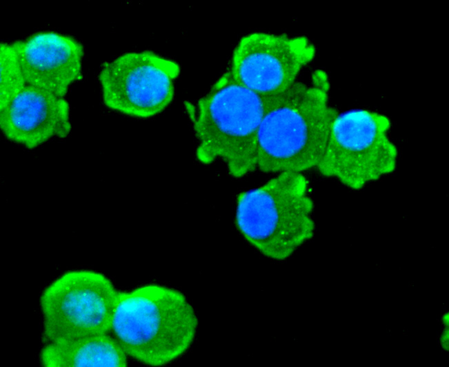 Choline Acetyltransferase Rabbit mAb