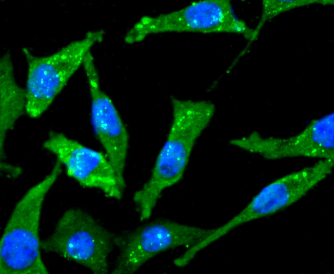 Choline Acetyltransferase Rabbit mAb