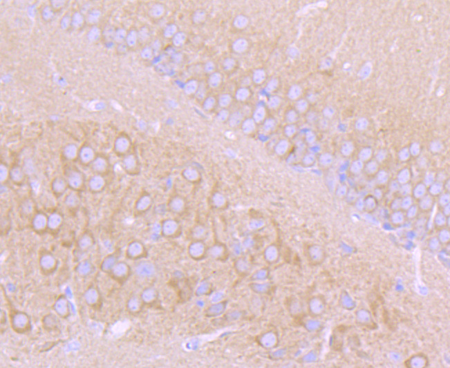 Choline Acetyltransferase Rabbit mAb