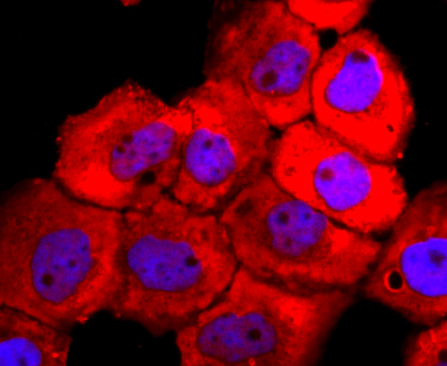 Tyrosinase Rabbit mAb