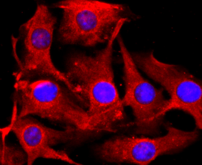 Tyrosinase Rabbit mAb