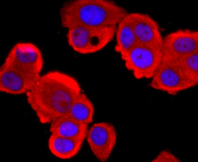 Tyrosinase Rabbit mAb