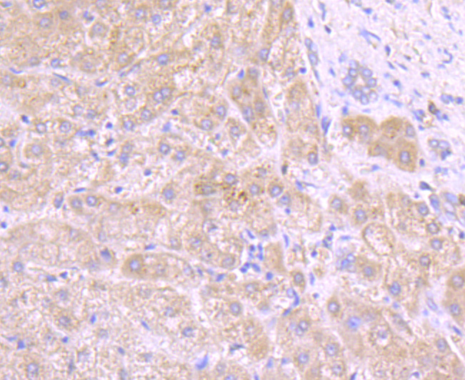 Tyrosinase Rabbit mAb