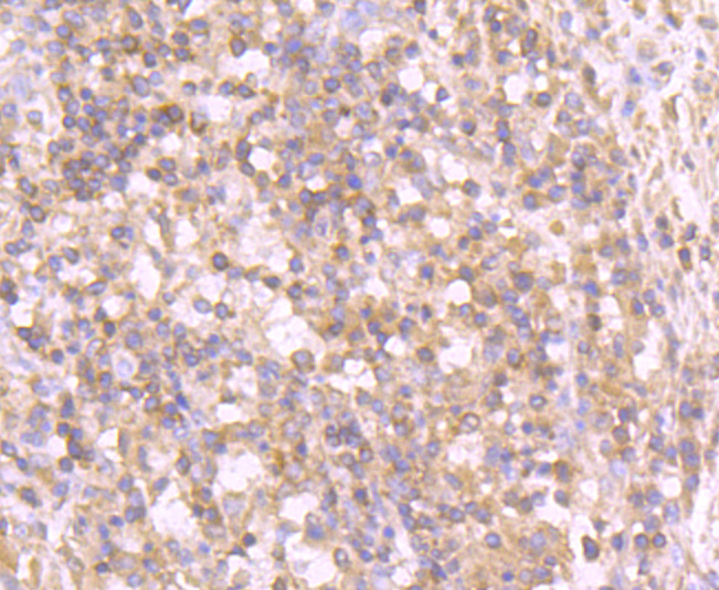 Tyrosinase Rabbit mAb