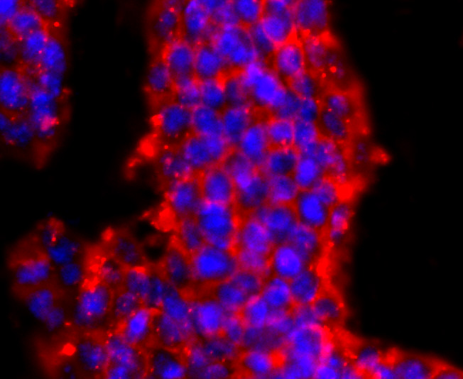 PRMT1 Rabbit mAb