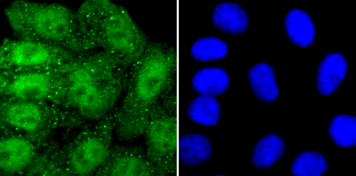 PRMT1 Rabbit mAb