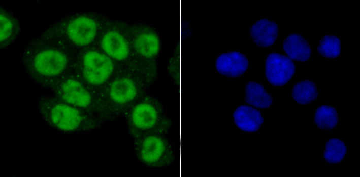 PRMT1 Rabbit mAb