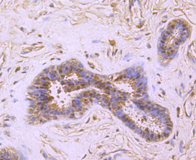 PRMT1 Rabbit mAb