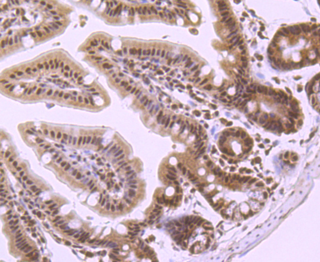 PRMT1 Rabbit mAb