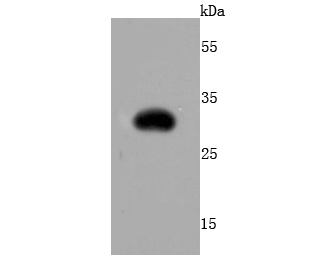 RFP Rabbit mAb