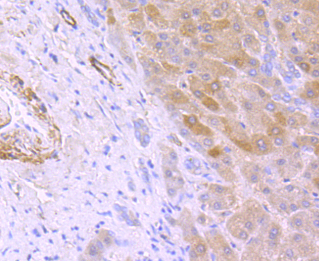 Hepcidin Rabbit mAb