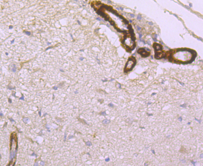 Hepcidin Rabbit mAb