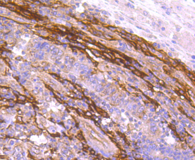 FAP1 Rabbit mAb