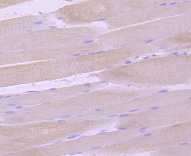 gamma Sarcoglycan Rabbit mAb