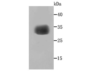 gamma Sarcoglycan Rabbit mAb