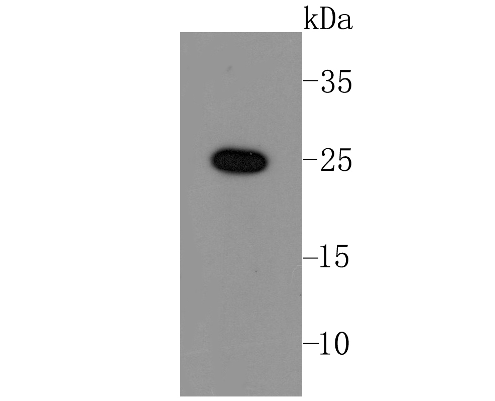 Lin28 Rabbit mAb