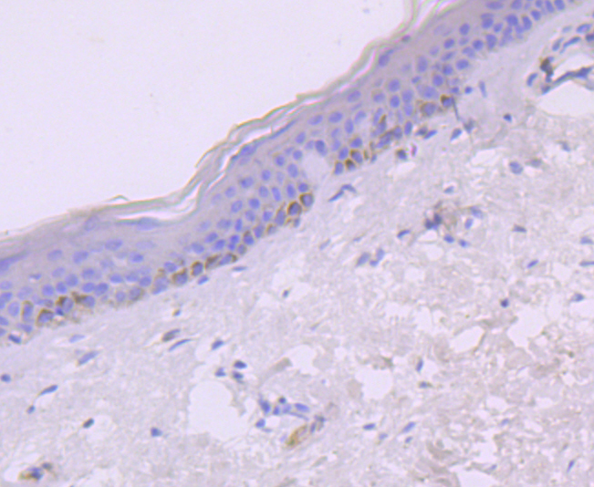 IP10 Rabbit mAb