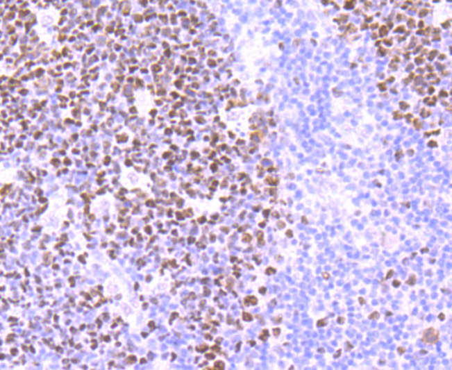 MSH6 Rabbit mAb