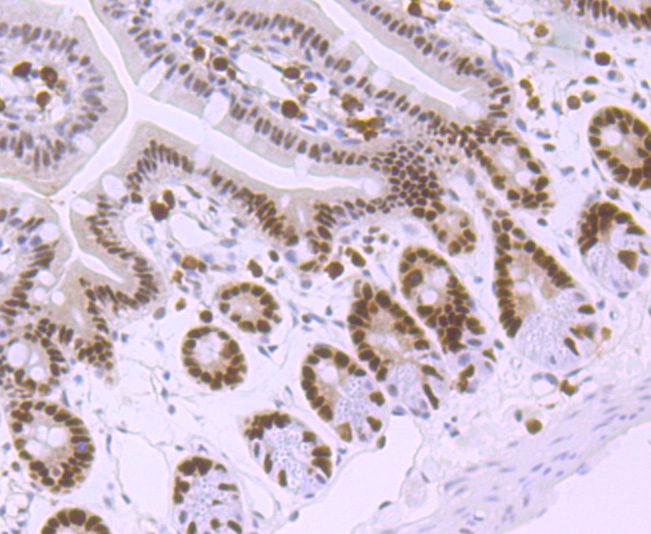 MSH6 Rabbit mAb