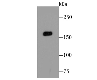 MSH6 Rabbit mAb