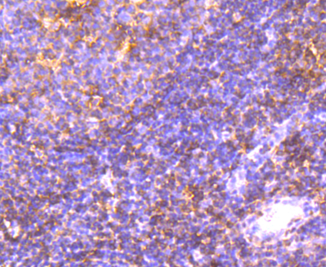 Integrin alpha 4 Rabbit mAb