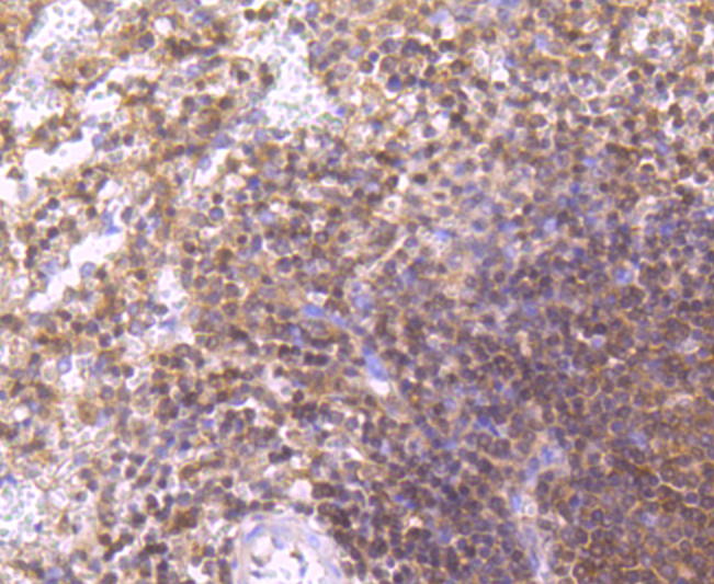 Integrin alpha 4 Rabbit mAb