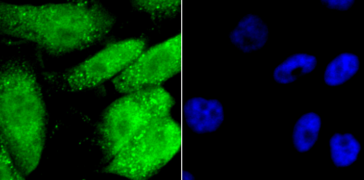 GATA4 Rabbit mAb