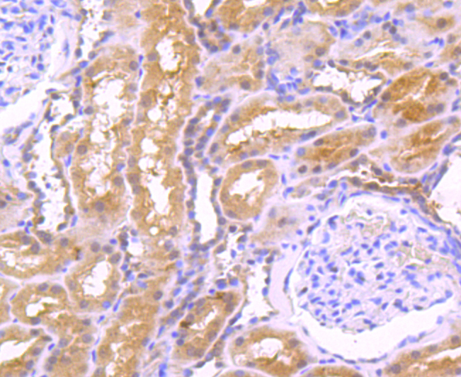 EGF Rabbit mAb