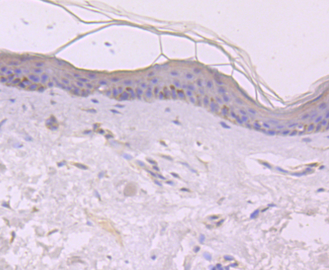 EGF Rabbit mAb