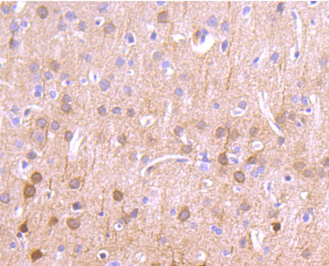 CaMKII delta Rabbit mAb