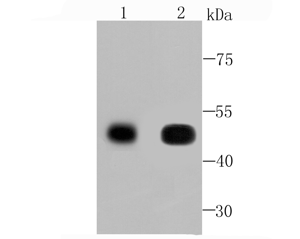 CaMKII delta Rabbit mAb