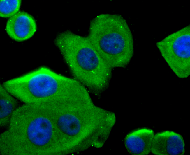 Glucose 6 Phosphate Dehydrogenase Rabbit mAb