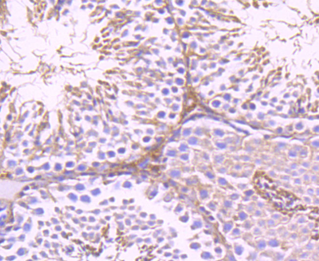 Glucose 6 Phosphate Dehydrogenase Rabbit mAb