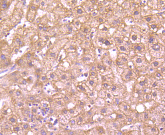 Glucose 6 Phosphate Dehydrogenase Rabbit mAb