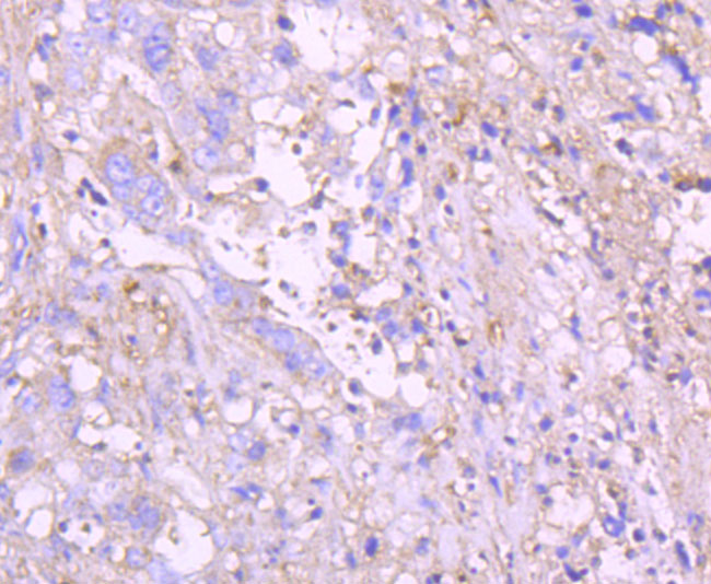 Glucose 6 Phosphate Dehydrogenase Rabbit mAb