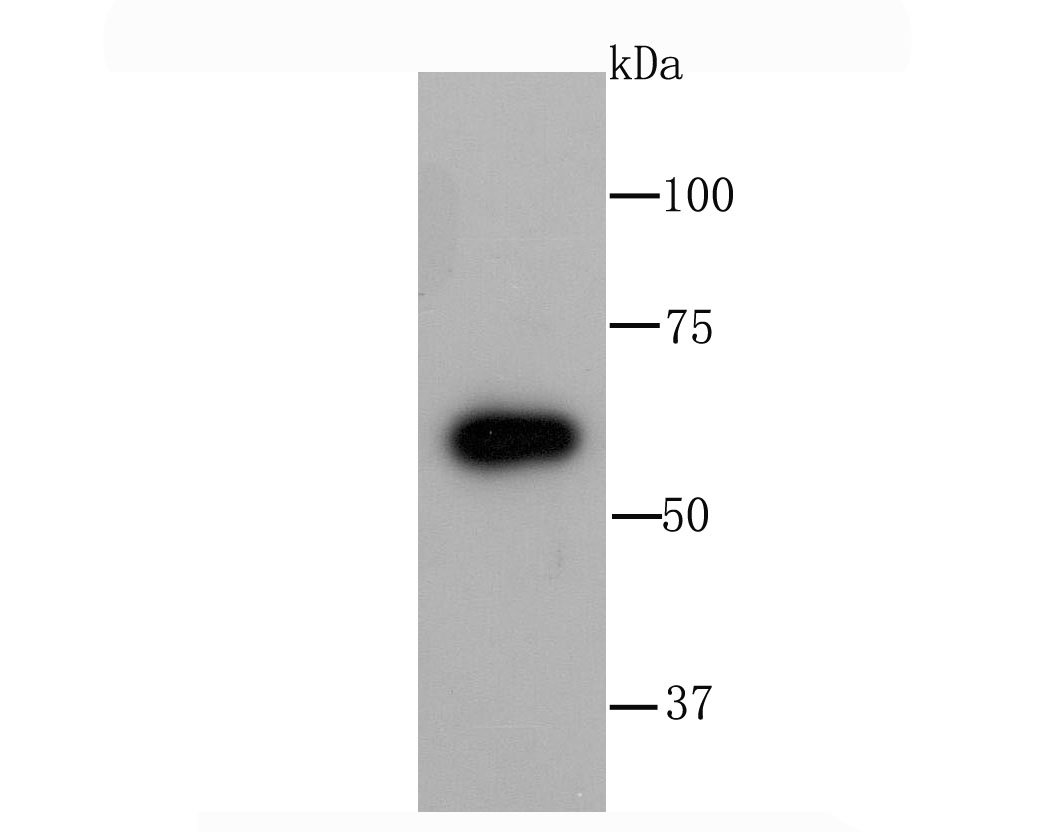 Glucose 6 Phosphate Dehydrogenase Rabbit mAb