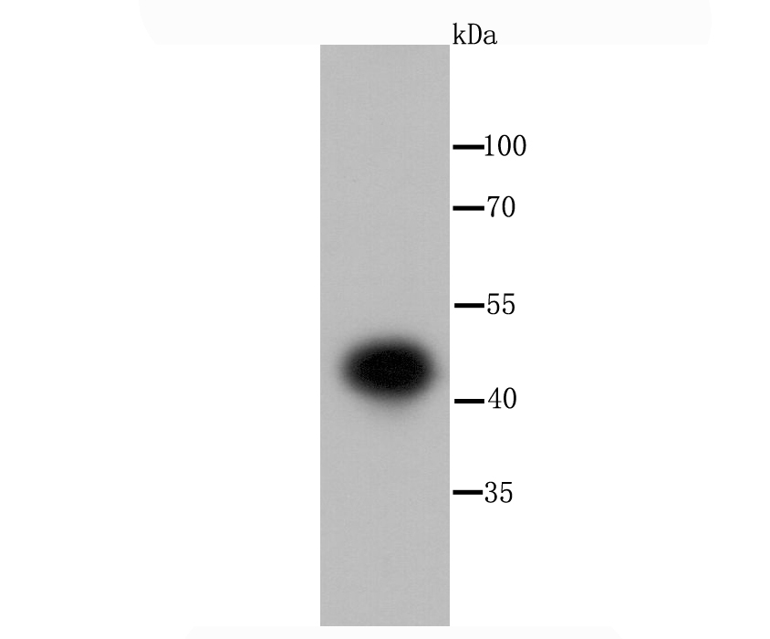 IKK gamma Rabbit mAb