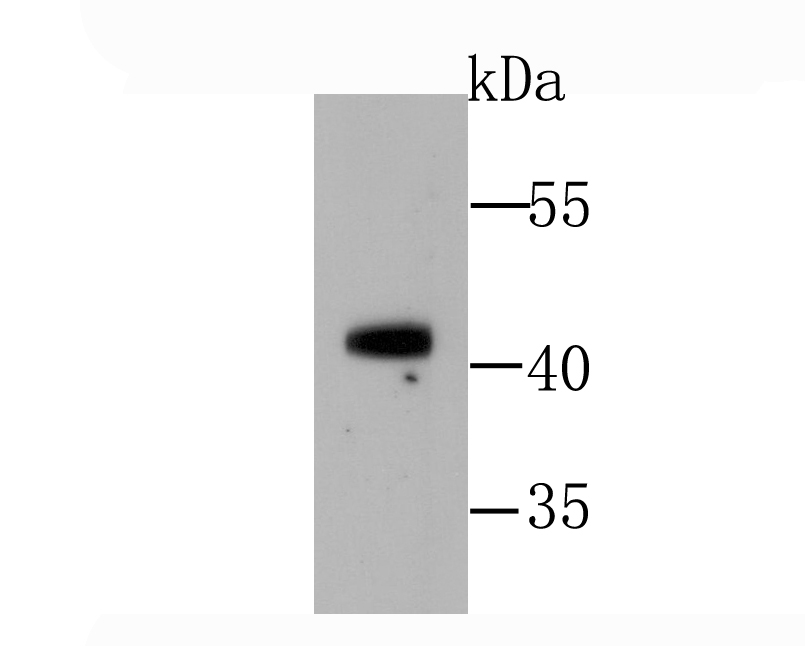 GATA1 Rabbit mAb