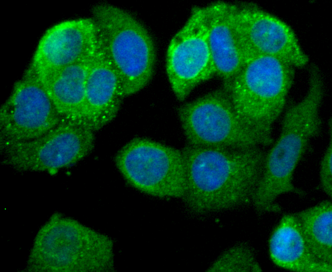 Leptin Receptor Rabbit mAb