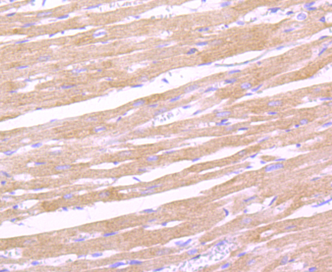 Leptin Receptor Rabbit mAb