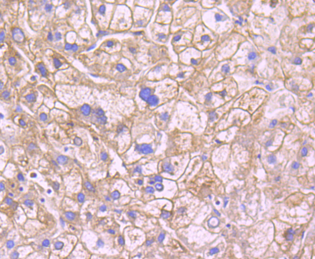 Leptin Receptor Rabbit mAb